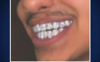 Florida Man Defrauds State of California For  Million, Buys Diamond Grills